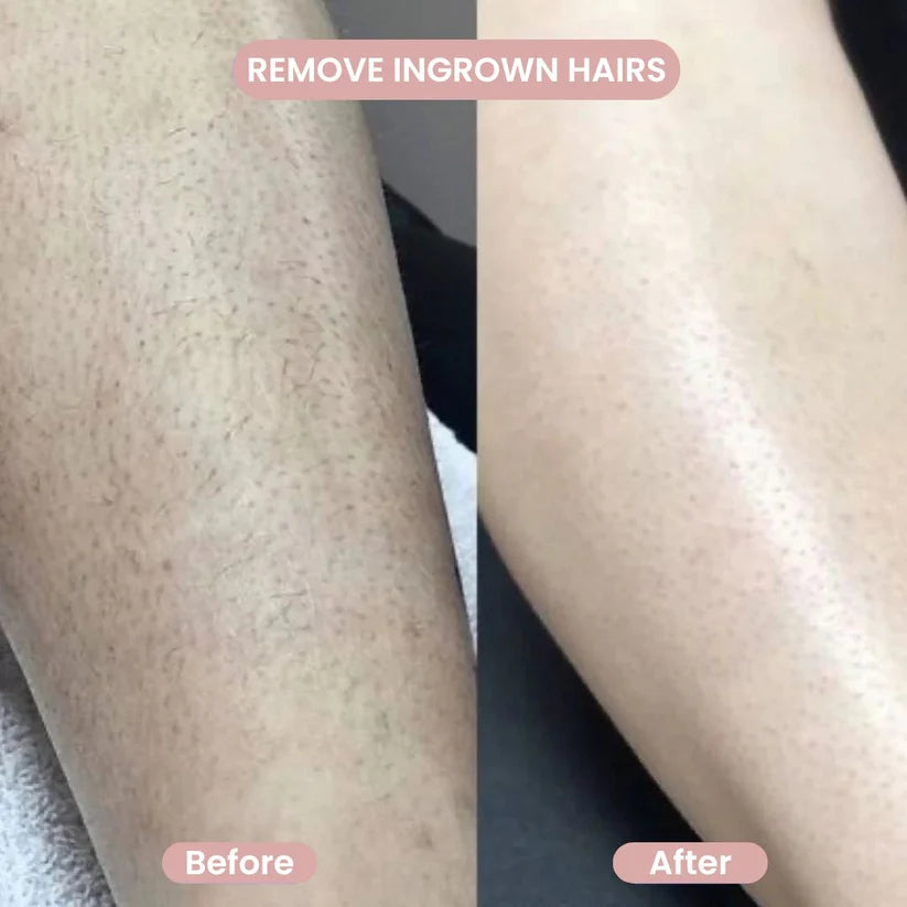2-in-1 Body Shaver – Painless Hair Remover
